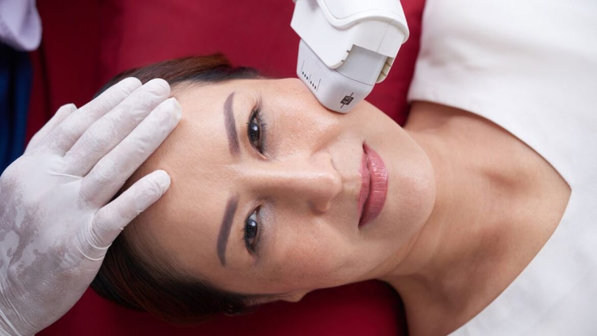 Unveiling the Surge in Popularity of Yellow Laser Treatment