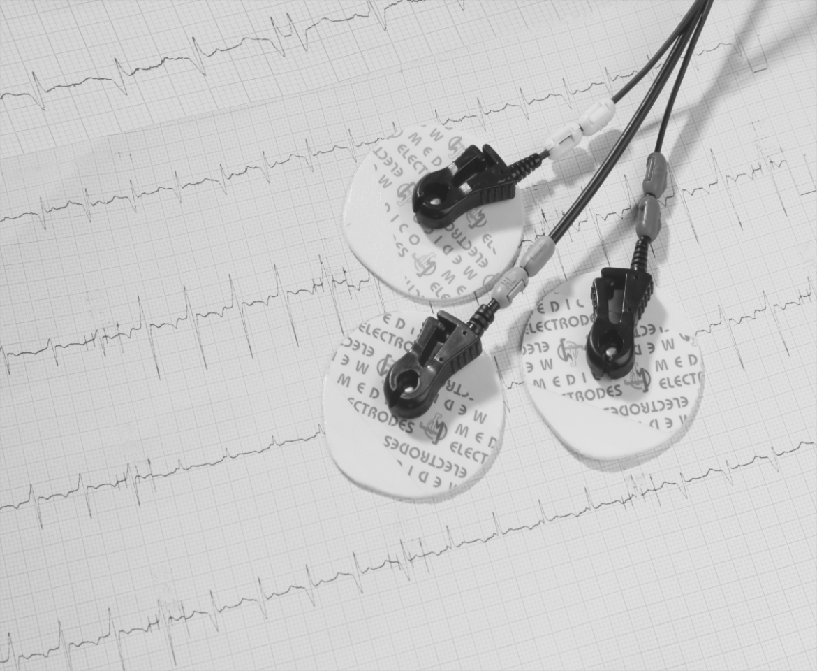 The Incredible Benefits of Using ECG Electrodes for Harnessing Precision