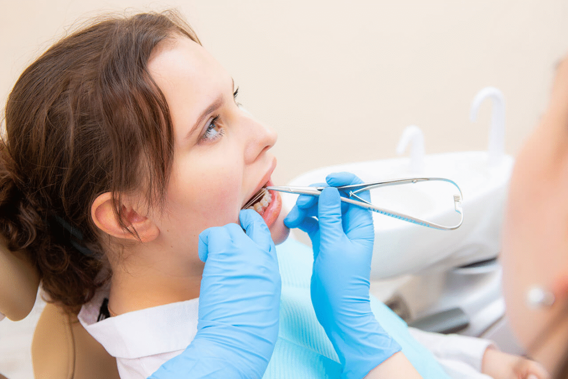 What Is the Best Self Ligating Braces Option?